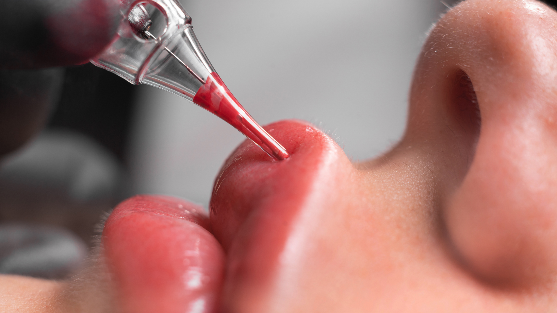 lipliner injektionsbehandling panna