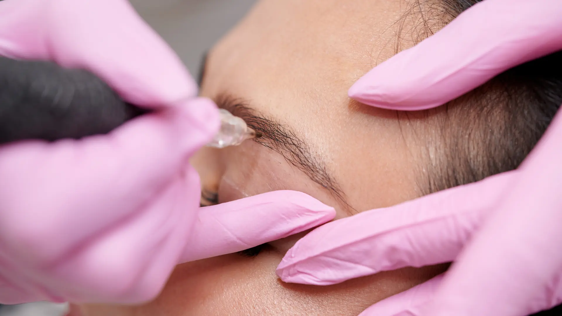 microblading treatment